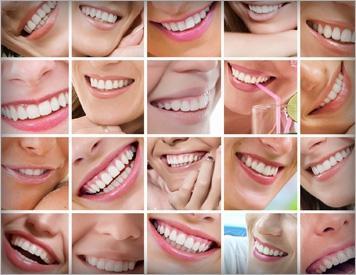 teeth whitening high point nc
