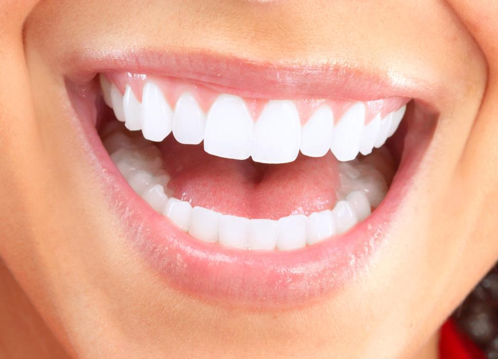 teeth whitening high point | woman smiling