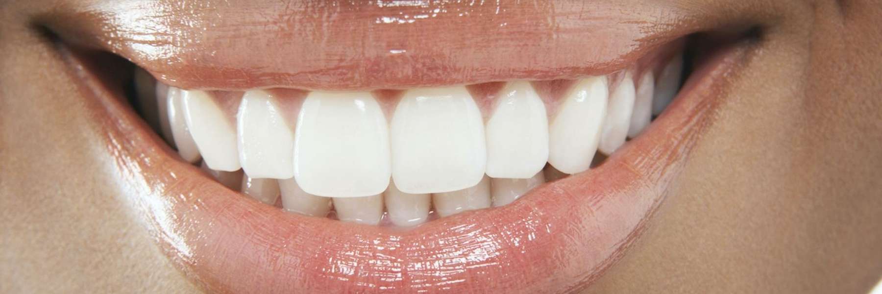 dental implant in High Point, NC