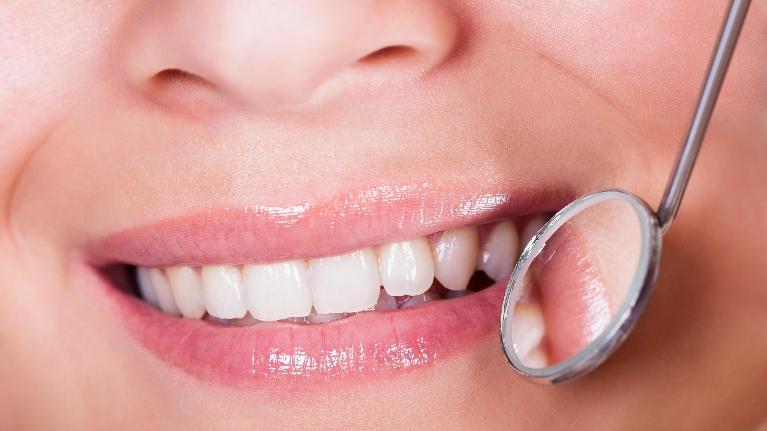 Patient's teeth during dental examination in High Point NC Dentist