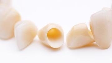 dental crowns on a white back drop | dentist high point