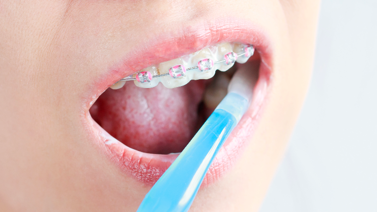 Oral Hygiene High Point NC