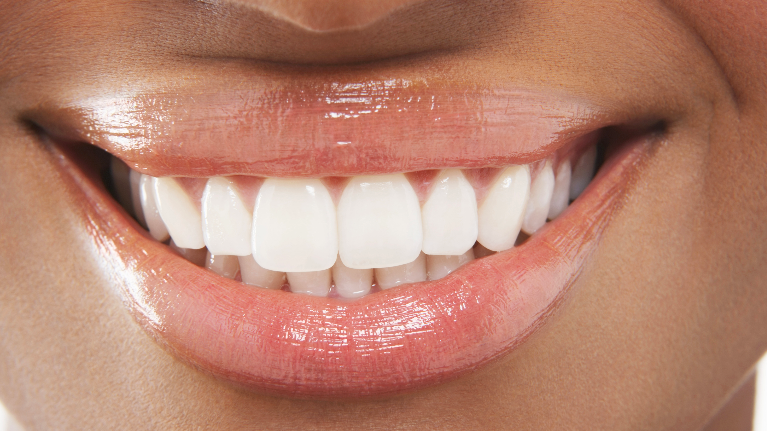 Dental Cleanings | High Point Dentist 