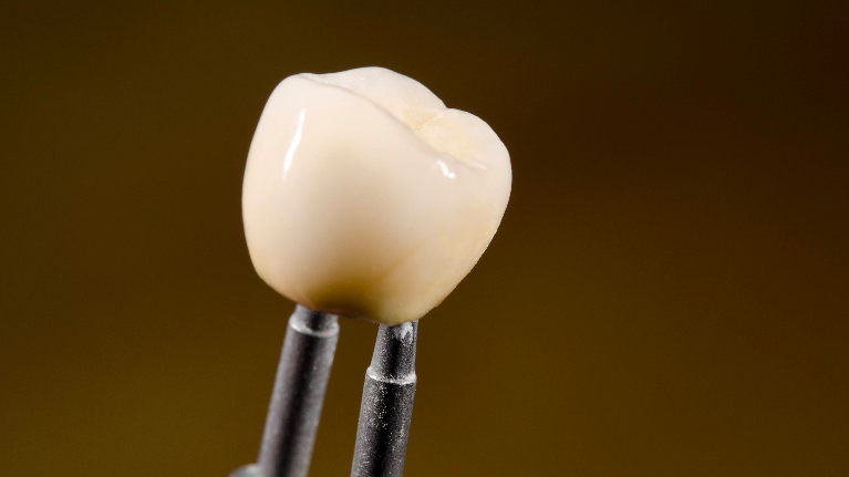 image of a dental crown in high point nc