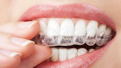 Girl putting on Invisalign clear aligners at Deep River Family & Cosmetic Dentistry