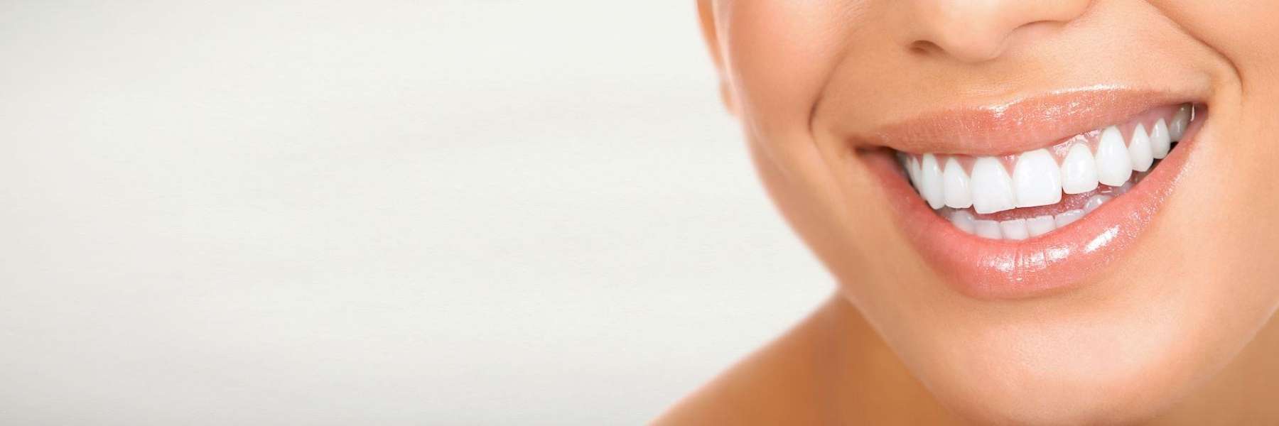 dental fillings high point | woman smiling